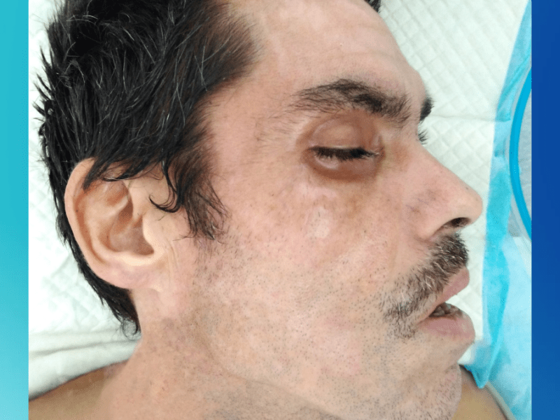 Paciente lleva desde noviembre sin ser reclamado por allegados en el Centro&nbsp;Médico